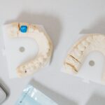 Dentist fitting a ceramic dental crown, illustrating dental crown cost considerations