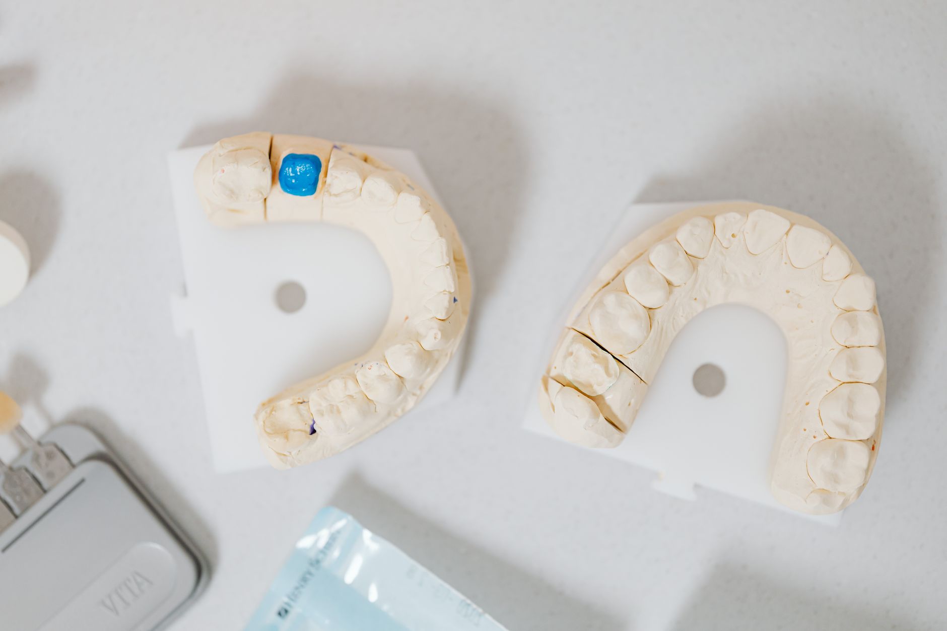 Dentist fitting a ceramic dental crown, illustrating dental crown cost considerations