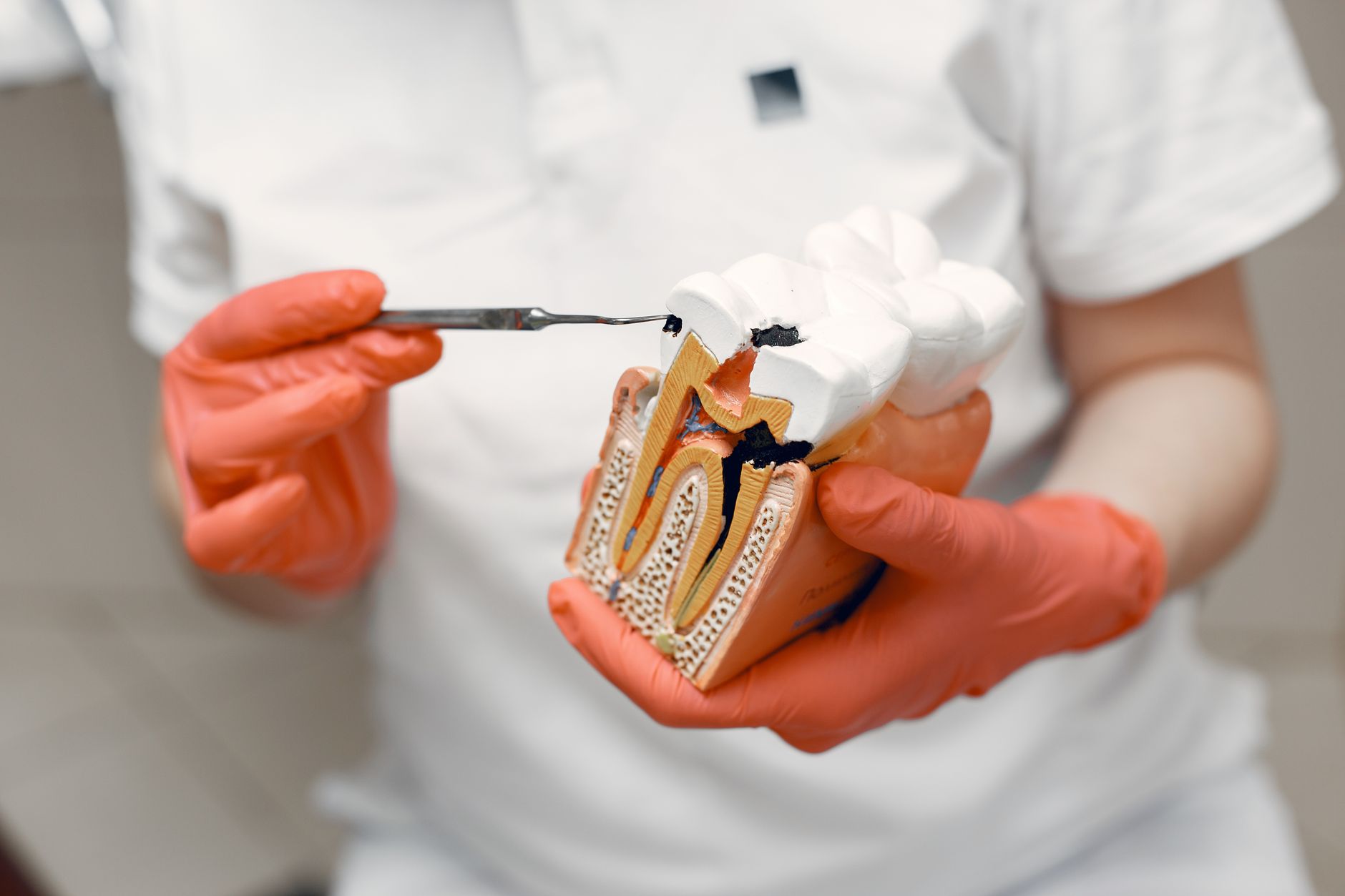Dentist explaining root canal vs extraction treatment options to patient