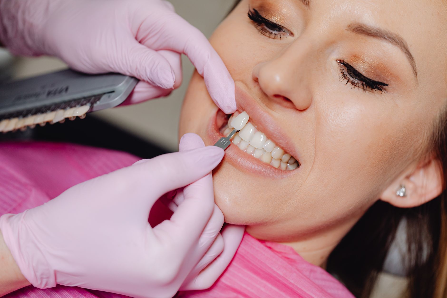 Close-up of a dentist showing dental veneers and discussing dental veneers cost