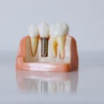 Dentist explaining dental implants with gum disease to patient