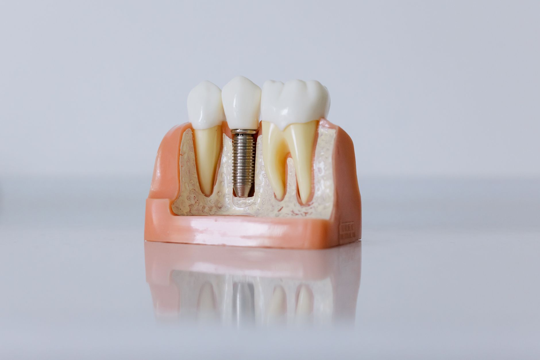 Dentist explaining dental implants with gum disease to patient