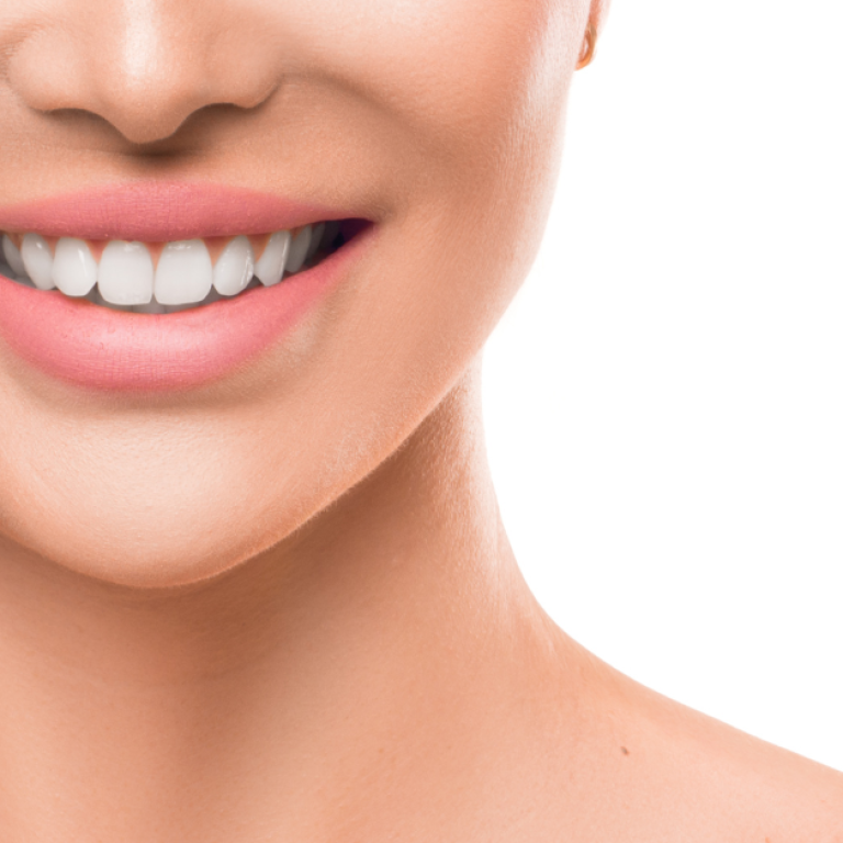 Teeth Whitening Tips