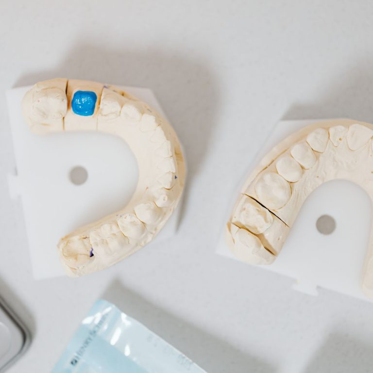 Dentist fitting a ceramic dental crown, illustrating dental crown cost considerations