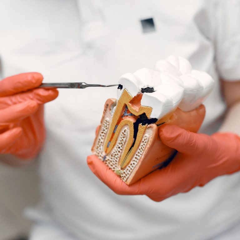 Dentist explaining root canal vs extraction treatment options to patient